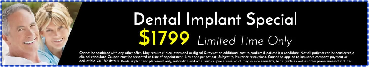 Dental Implants Special