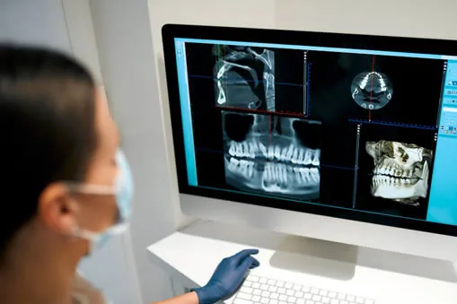 Digital dental x-ray imaging equipment