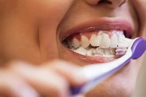 Managing Tooth Sensitivity During Whitening