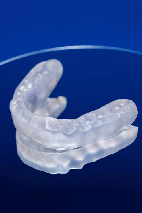 Teeth grinding mouth guard at Allure Family Dental & Specialty Group