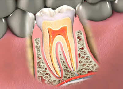 Root Canal Therapy: Know the Symptoms and When to Seek Treatment