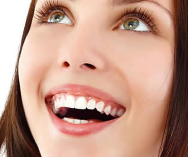 Details about Ceramic Dental Veneers