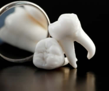 When Should Wisdom Teeth Be Removed?
